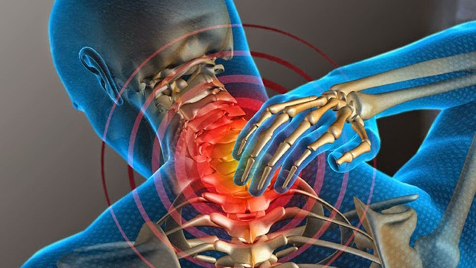 ¿Cómo recibir una indemnización por latigazo cervical después de sufrir un accidente de tráfico?